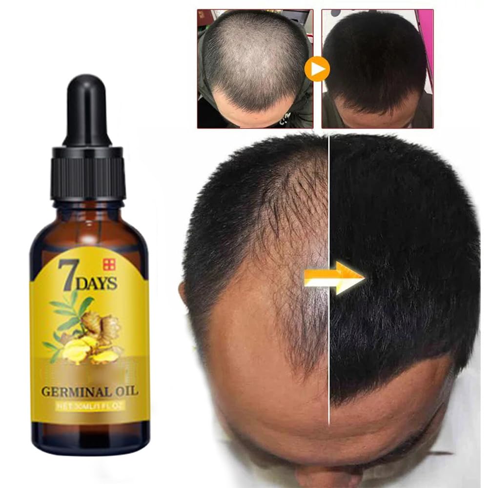 BRAND NEW ~ NWT ~ Set/2 Ginger Hair Growth Oil Hair Thickness Scalp Treatment