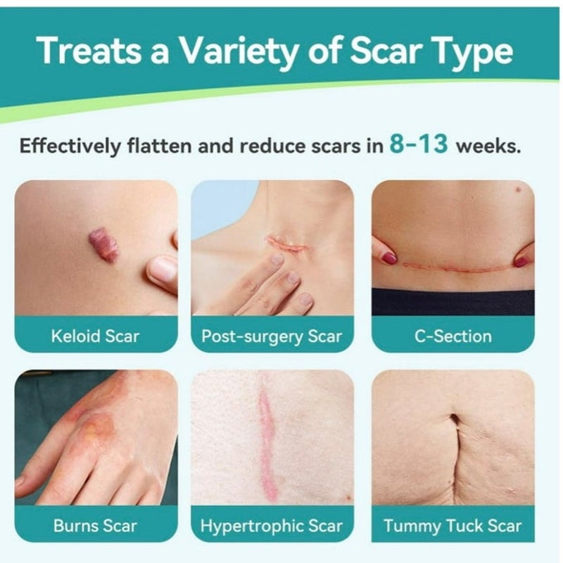 BRAND NEW ~ Waterproof Medical Silicone Untra-thin Scar Removal Tape Sheets