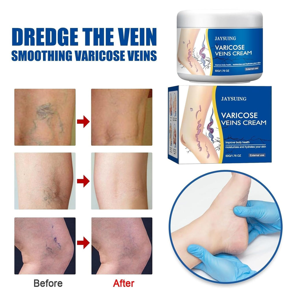 BRAND NEW ~ NWT ~ Set/2 Leg Varicose & Spider Vein Cream ~ Soothing Moisturizing