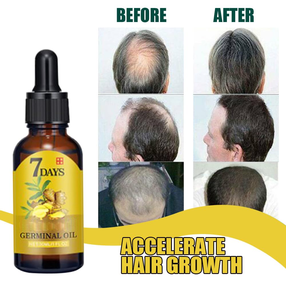 BRAND NEW ~ NWT ~ Set/2 Ginger Hair Growth Oil Hair Thickness Scalp Treatment