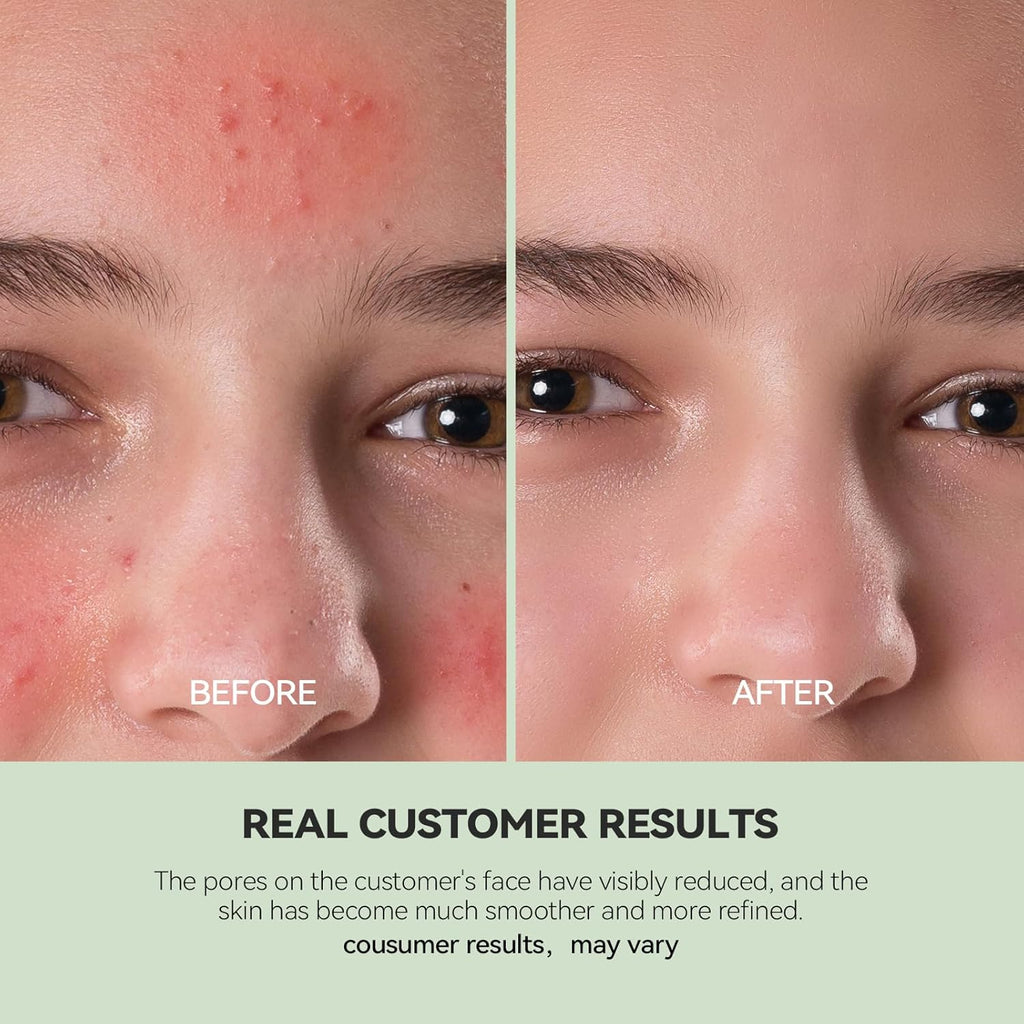 BRAND NEW ~ Duo Cleansing Clay Face Mask Deep Pore Cleanser with Hyaluronic Acid