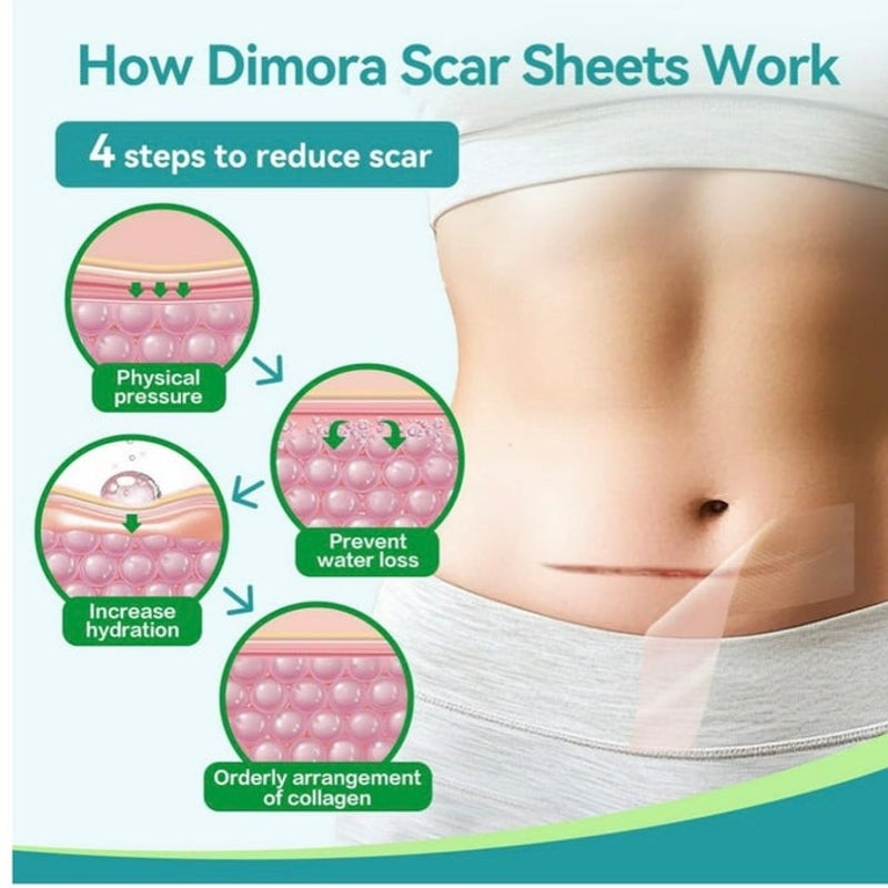 BRAND NEW ~ Waterproof Medical Silicone Untra-thin Scar Removal Tape Sheets